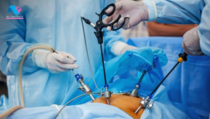 Surgery
